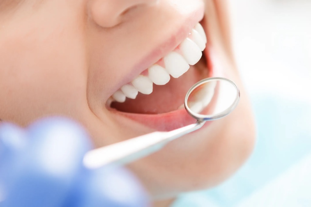 Primer plano de una sonrisa sana