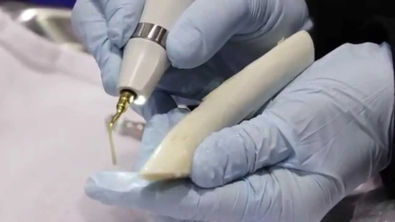 How Piezosurgery® Is Changing Bone Surgery in Dentistry Video Thumbnail